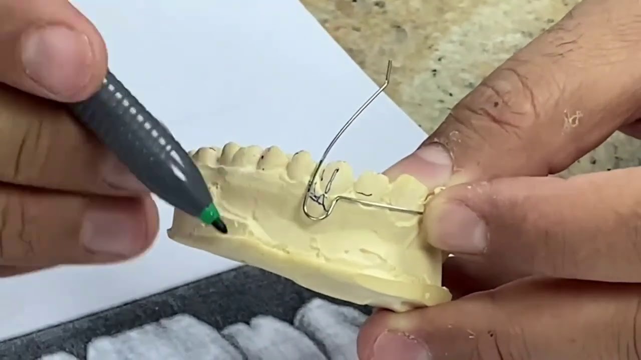 ortho labial arch الأستاذ احمد المحروم