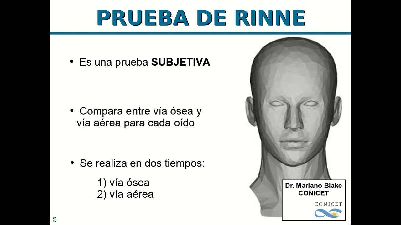 Pruebas Acumétricas Parte 1 - Pruebas de Rinne y Weber