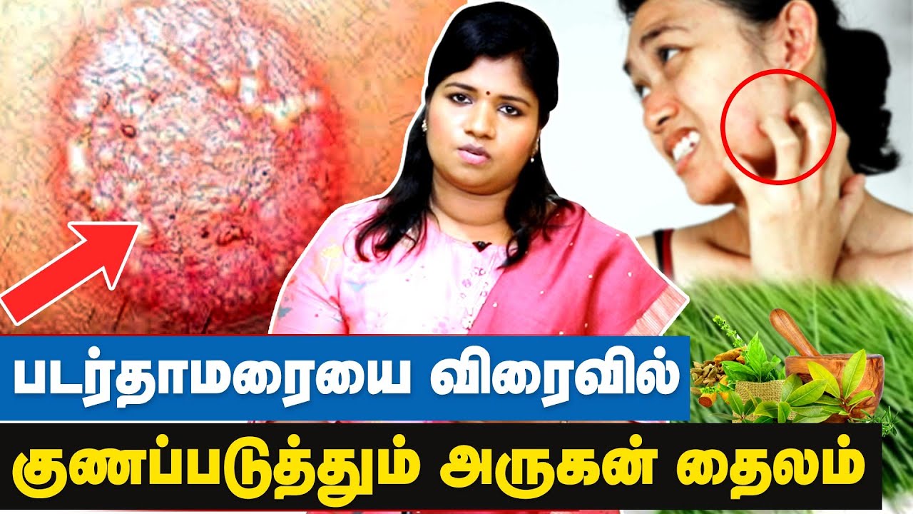 தோல் வியாதிகளுக்கான முழுமையான தீர்வு...! Dr Yogavidhya | Arugan Thailam | Skin Disease Treatment