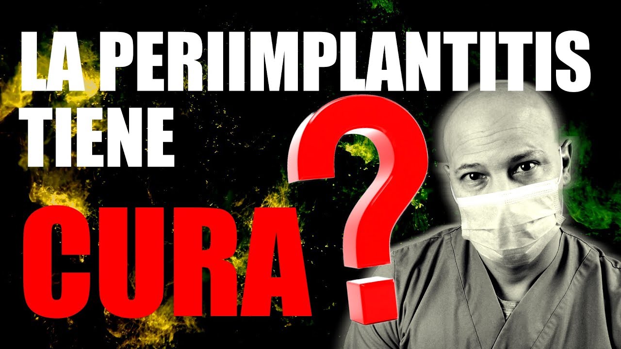 LA ENFERMEDAD QUE ESTA ATACANDO A LOS IMPLANTES DENTALES.