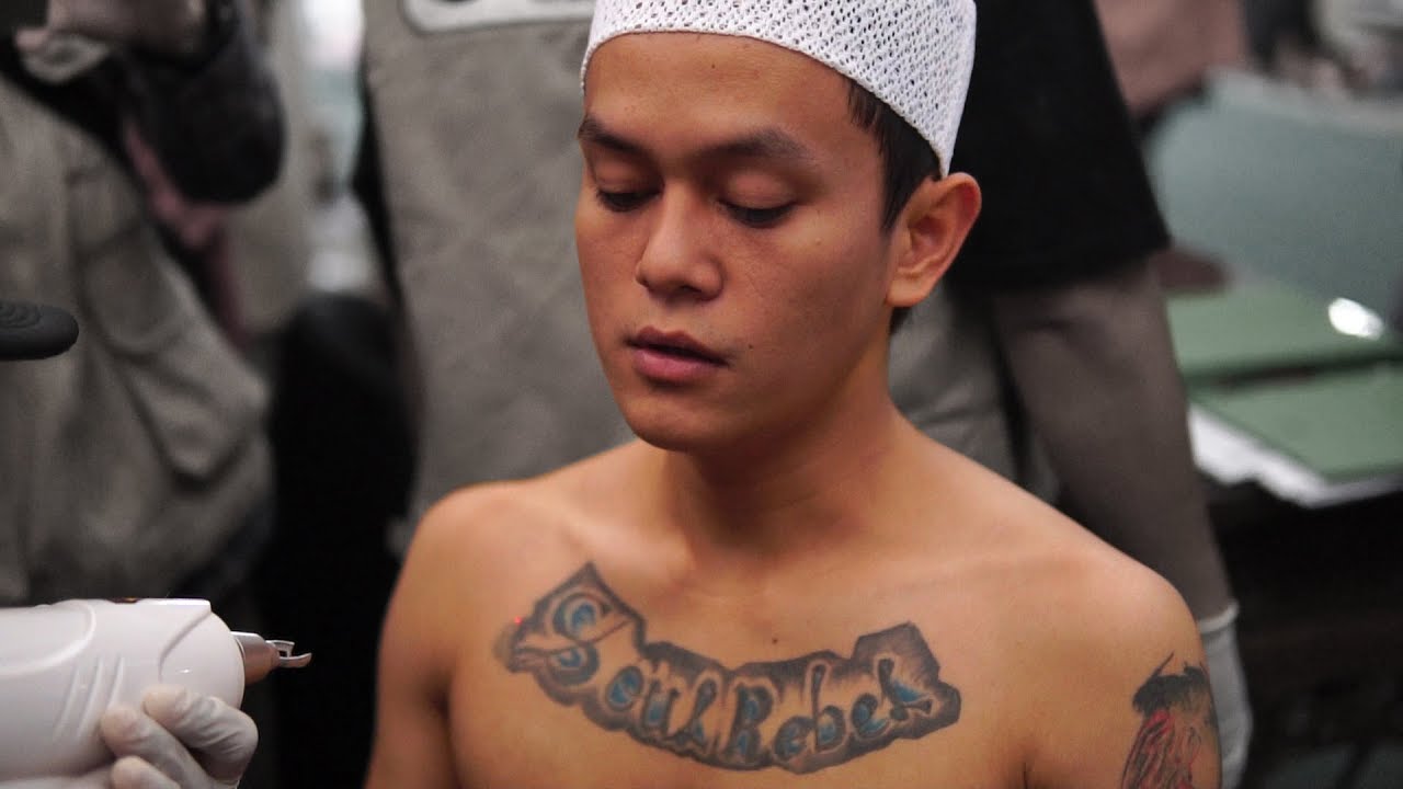 HAPUS TATO GRATIS !!! - Free Tattoo Removal