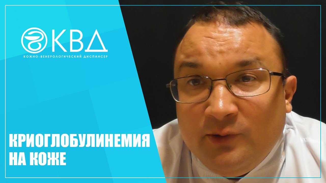 1415  Криоглобулинемия на коже