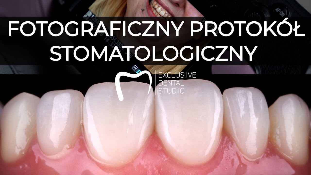 Pakiet Diagnostyczny - Fotograficzny protokół stomatologiczny  #VLOG2