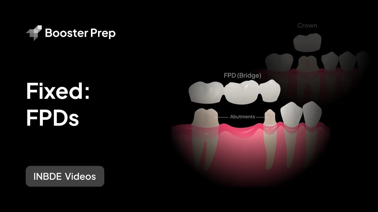 Prosthodontics | Fixed: FPDs | INBDE, NDEB, ADAT