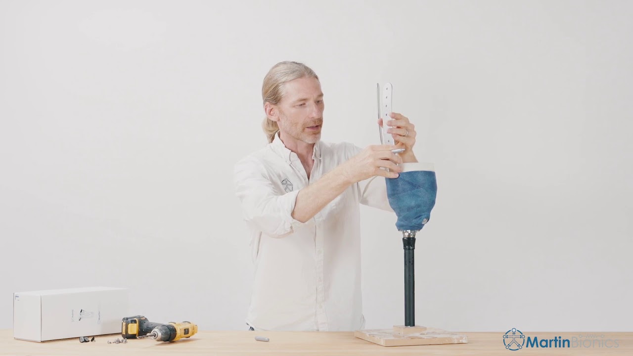 The New Socket less Socket™ cX Hybrid™ | Martin Bionics