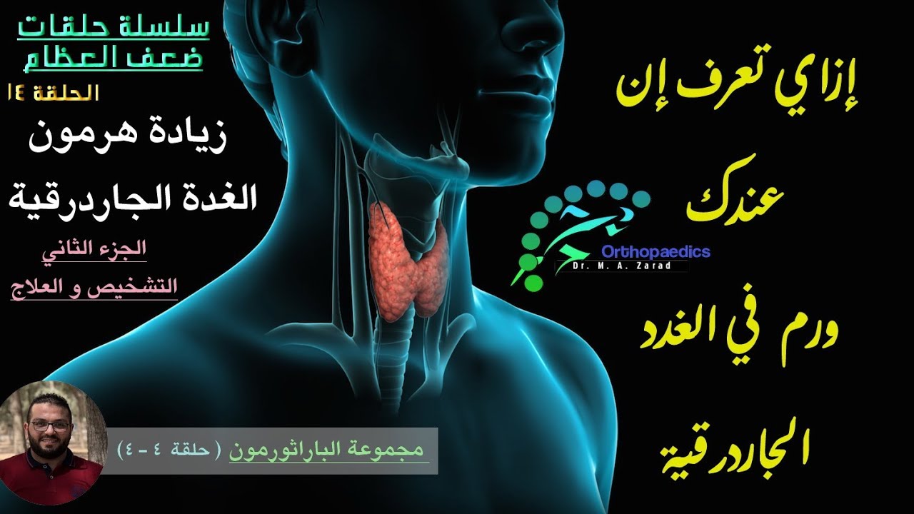 إزاي تعرف إن عندك ورم في الغدد الجاردرقية ؟! | التشخيص والعلاج | ج4 | سلسلة ضعف العظام | ح14