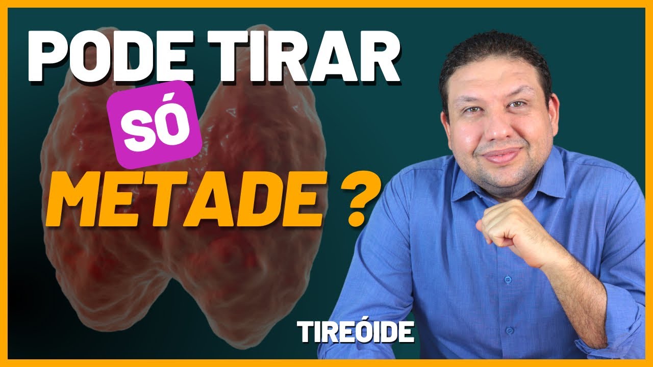 CIRURGIA DE TIREÓIDE. PODE OPERAR SÓ METADE DA TIREÓIDE ? tireoidectomia parcial