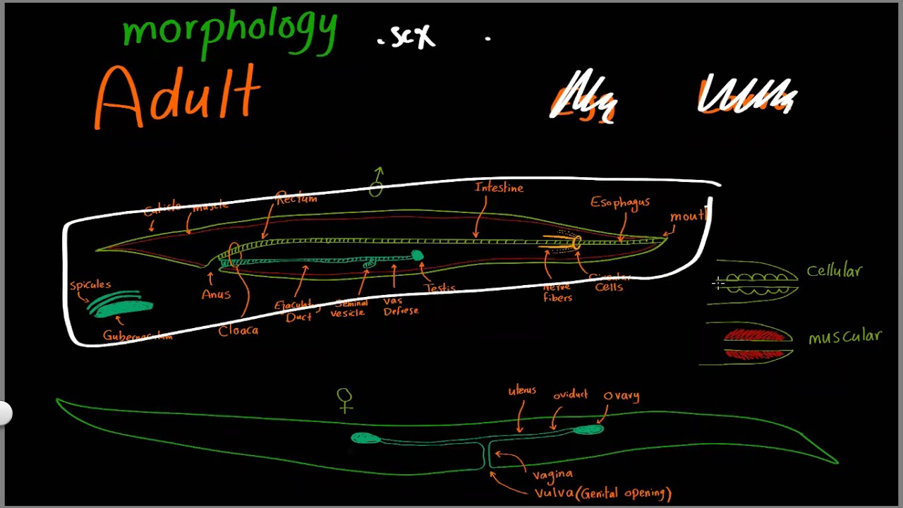 Parasitology 11 Nematodes General  »DrMoaz