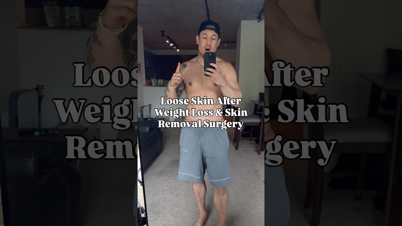Loose Skin After Weight Lose & Skin Removal Surgery #tummytuck #looseskin #weightloss #mensfitness