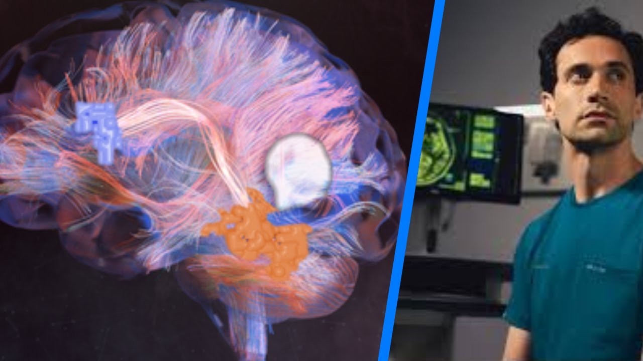 Connectomic Strategies for Brain Tumors | Randy D'Amico - NERVE Advisor From Lenox Hill Neurosurgery