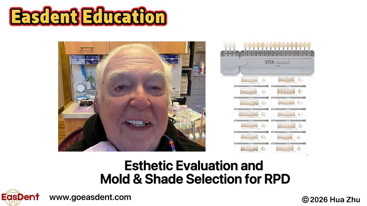 Esthetic Evaluation, Mold, and Shade Selection for RPD Fabrication