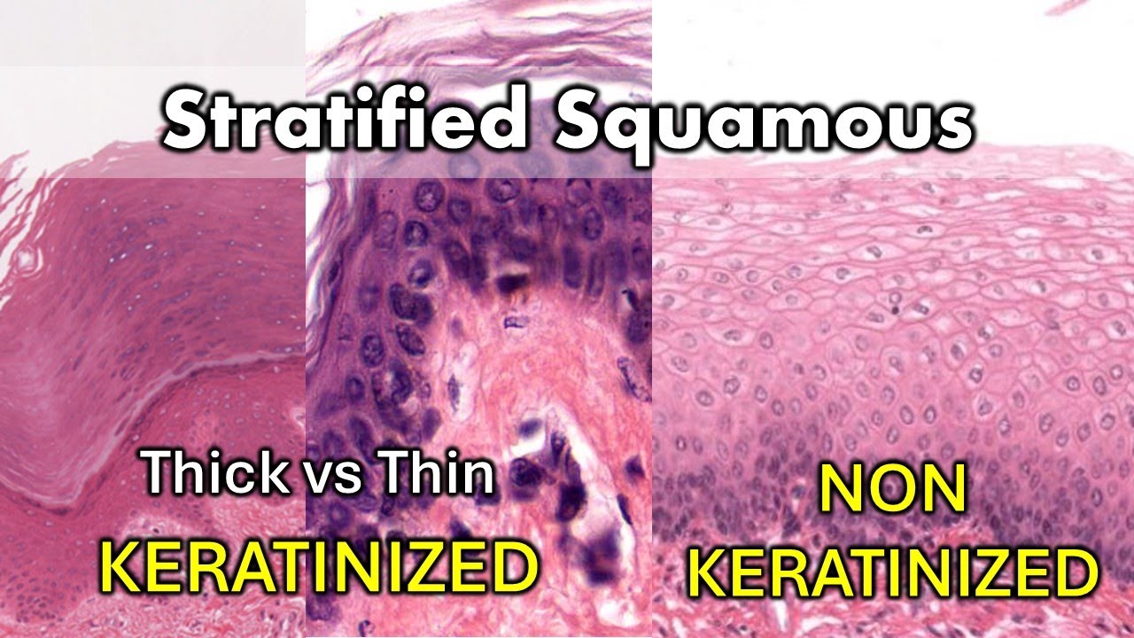 Keratinized vs Non Keratinized, Thick vs Thin