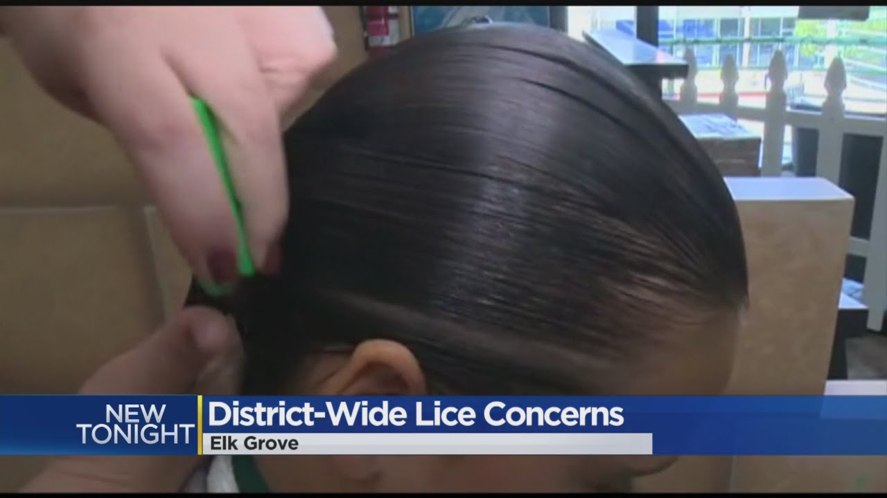 Elk Grove Lice Problems Have Parents Itching For School Policy Change