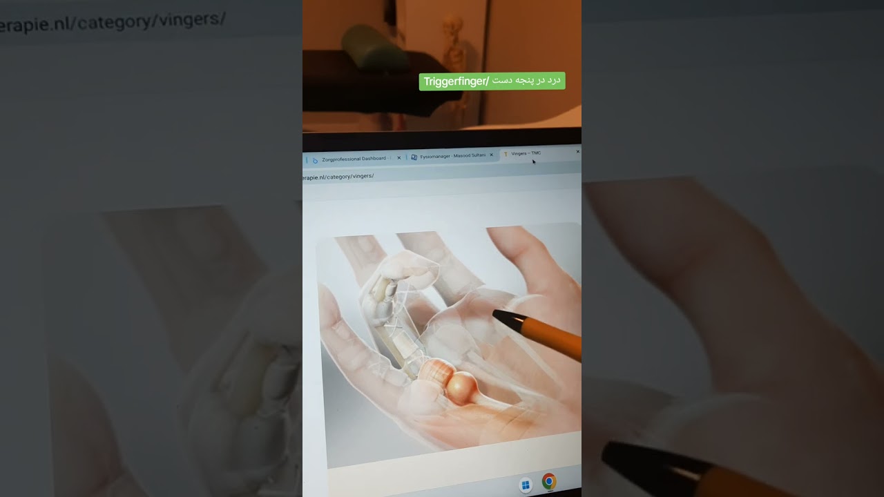 درد در پنجه هاي دست/ Triggerfinger
