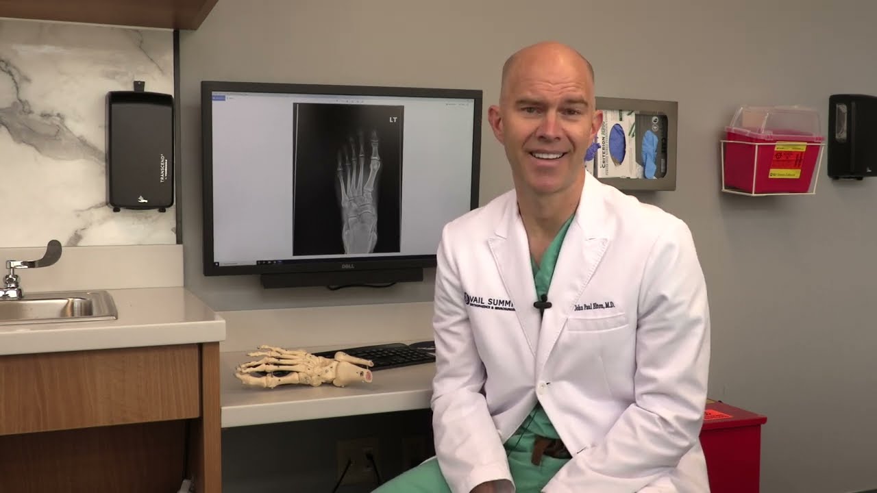 What Causes Bunions?