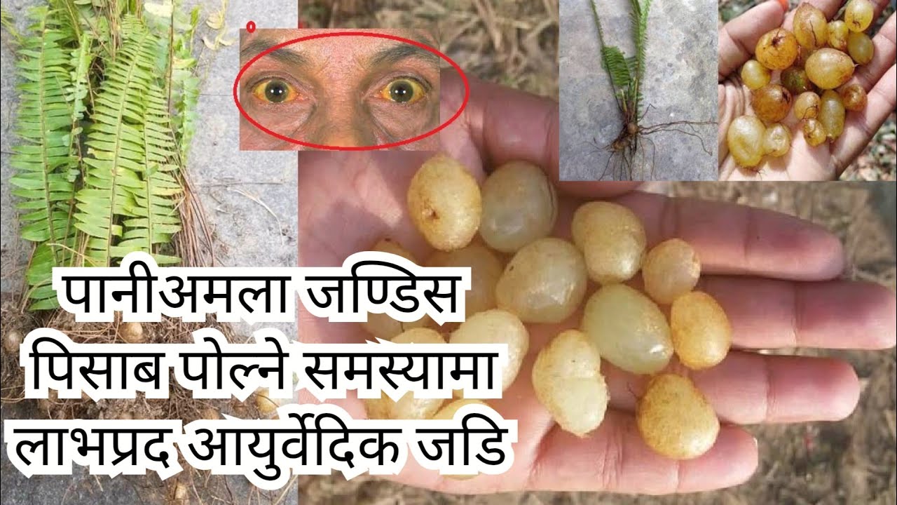 पानीअमला जण्डिस पिसाब पोल्ने समस्यामा लाभप्रद आयुर्वेदिक जडि