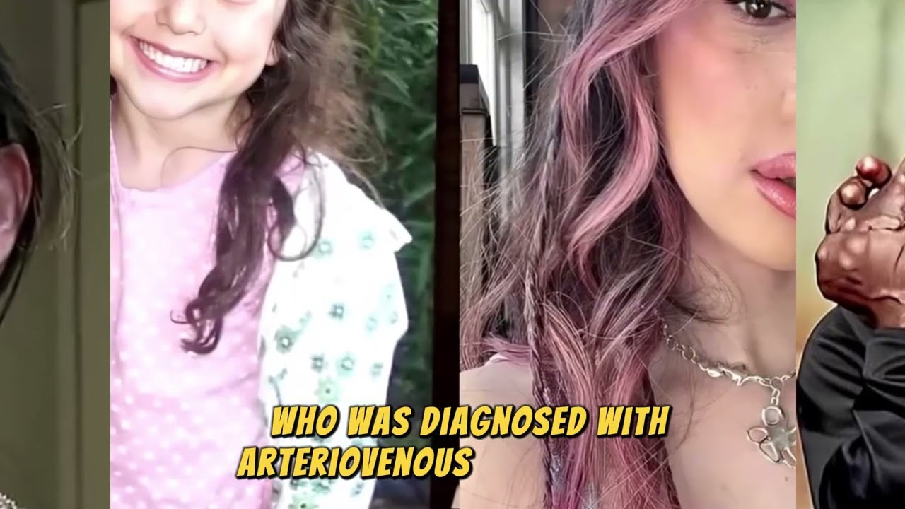 6 People With Wired Disease Around the World