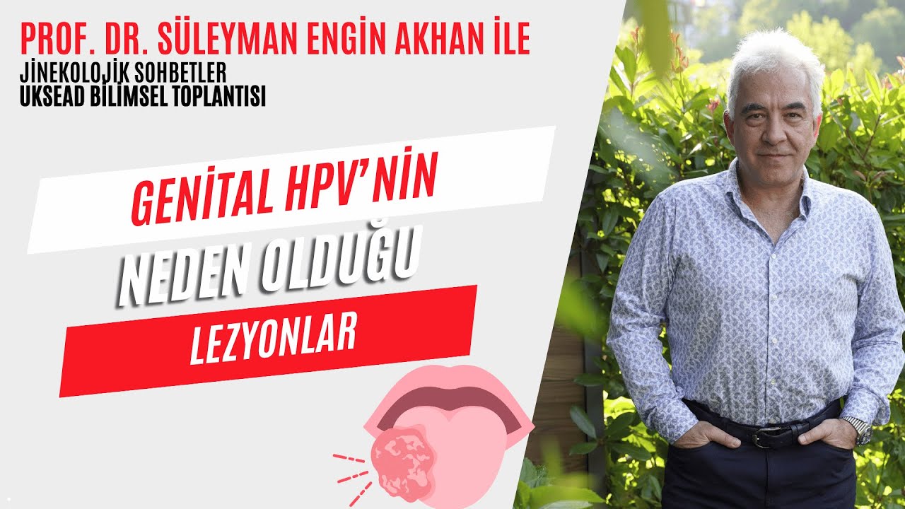 Genital hpv nin neden olduğu lezyonlar. - Prof. Dr. Süleyman Engin Akhan