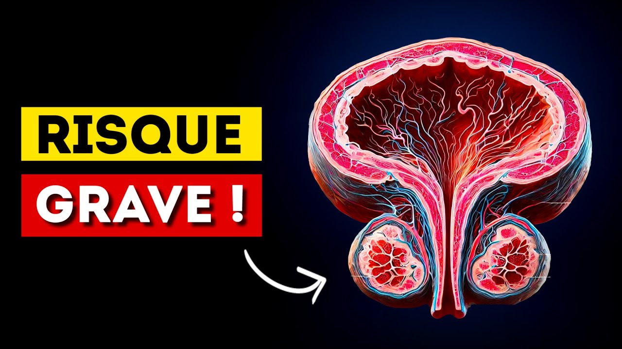 Tous les hommes devraient savoir ceci à propos de la prostate (C'est important)