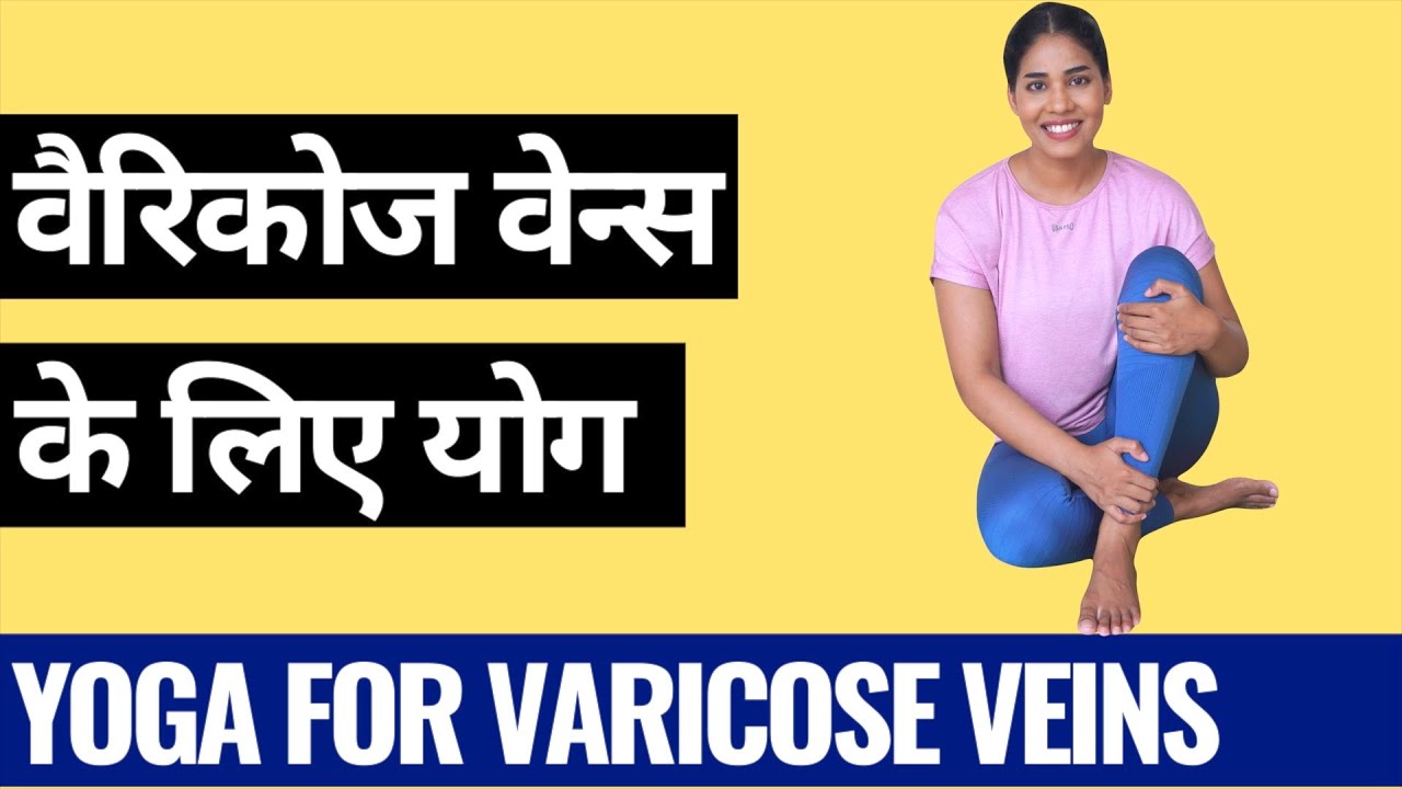Yoga for Varicose Veins I Yoga for Varicose / Spider Veins I Tips to get rid of Varicose Veins