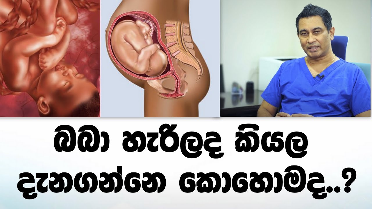 ගර්භාෂයේ සිටින දරුවාගේ පිහිටීම | What position is my baby in? | Dr.Vijith Vidyabushana