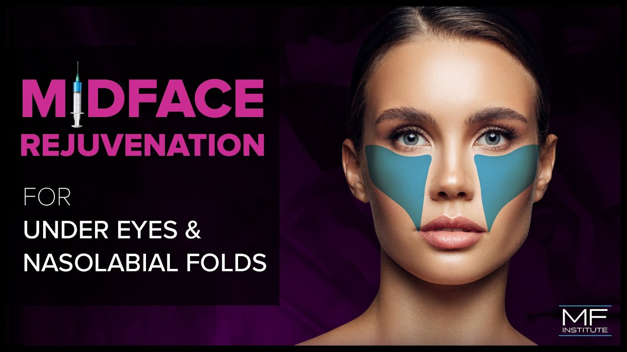 Under Eye and Midface Rejuvenation with Dermal Fillers at Mabrie Facial Institute