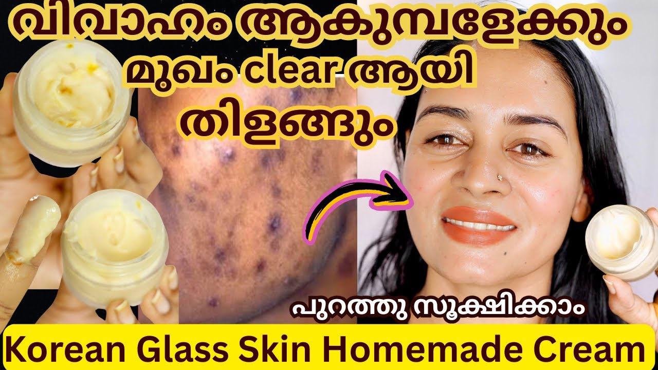 എത്ര വല്യ കറുത്ത പാടുകളും മായിച്ചു മുഖം തിളങ്ങി വെളുക്കും ഈ കൂട്ട് തേച്ചാൽ മതി pre Bridal clearskin