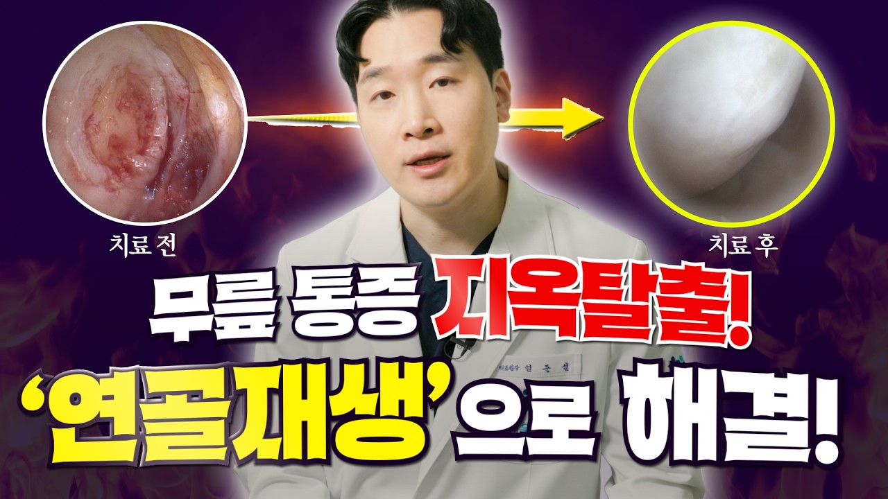 무릎 통증 지옥탈출!! 연골재생으로 해결 (콜라겐유도 연골재생치료)