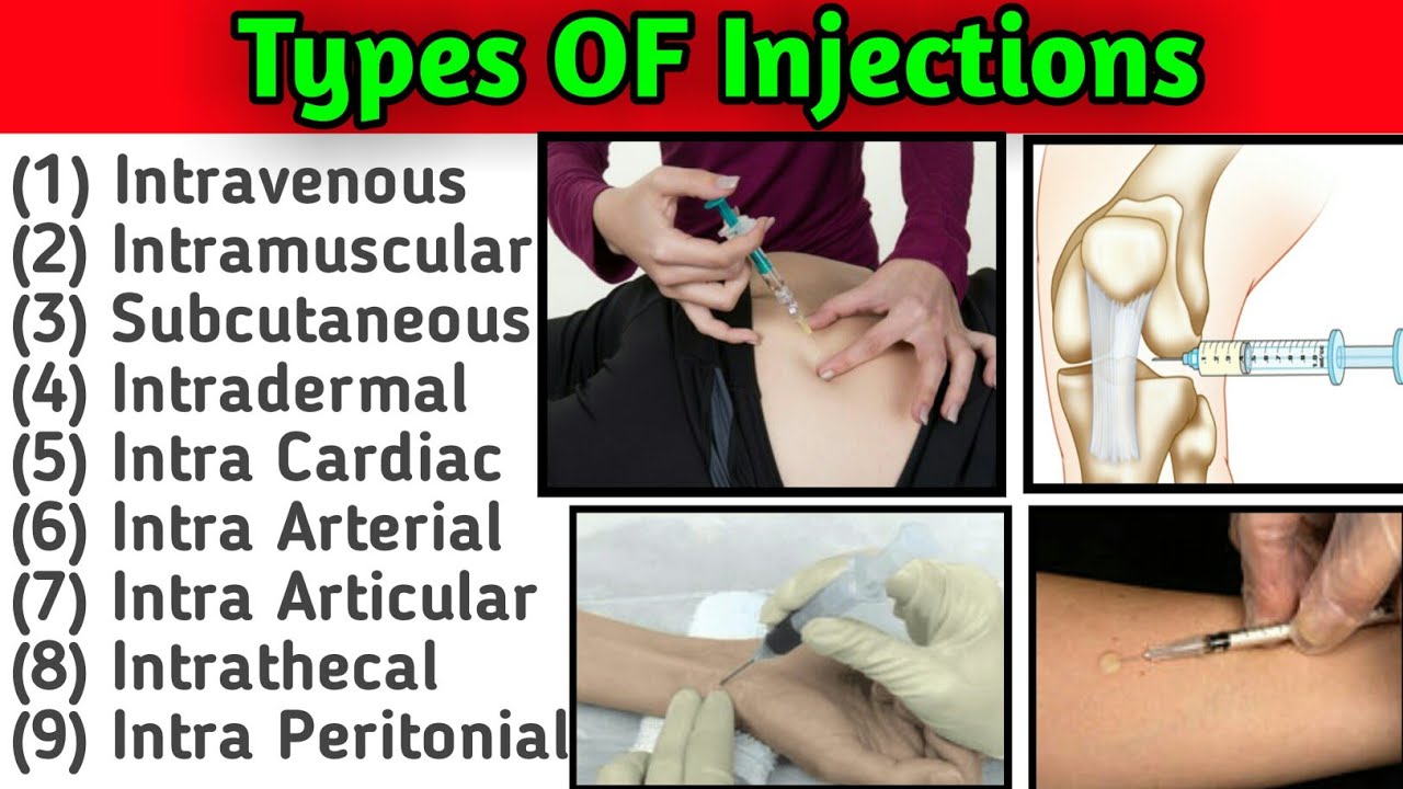 Types of Injection and their Sites ||  Routes and Angle of Insertion