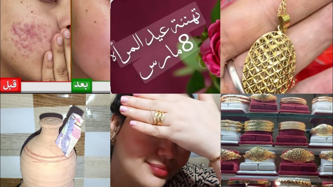 بمناسبة 8 مارس❤️جبت ليكم ماسك وغاسول طبيعيين🌹 لبشرة اللي فيها الحبوب باش ترجعي لبشرة نقية ومشرقة🧖‍♀️