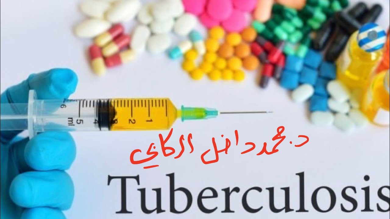 Tuberculosis