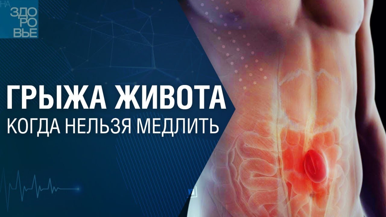 Грыжа живота. Когда нельзя медлить. На здоровье 30.08.2025