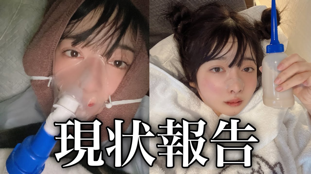 【壮絶】整形した！生きてます！！！！！