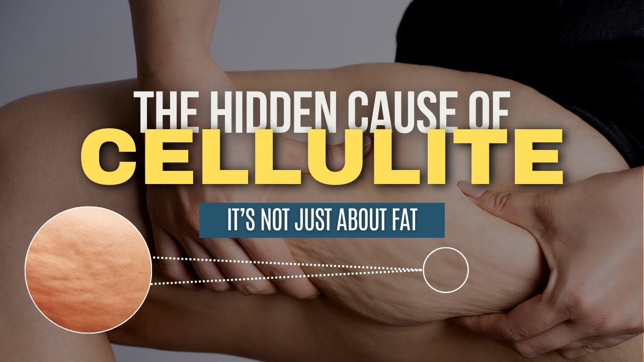Understanding what causes Cellulite: the Fascia, Alignment, and Lymph Connection