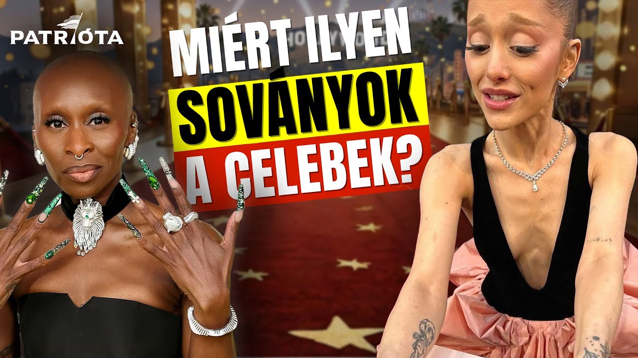 Itt az új szépségideál? Már megint mi történik Hollywoodban? | Janka Trending