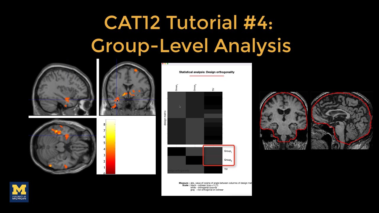 CAT12 #4: Group-Level Analysis
