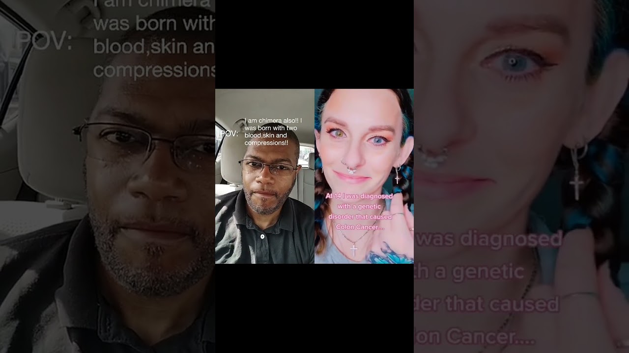 Understanding chimerism: a rare genetic condition#chimera #rarecondition #genetics