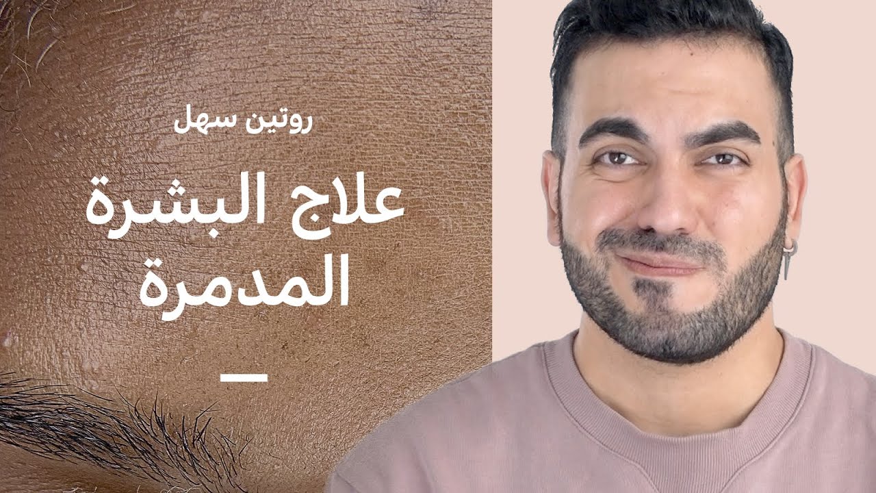 روتين لعلاج التهاب وتهيج البشرة 🥵 تصليح حاجز البشرة للرطوبة