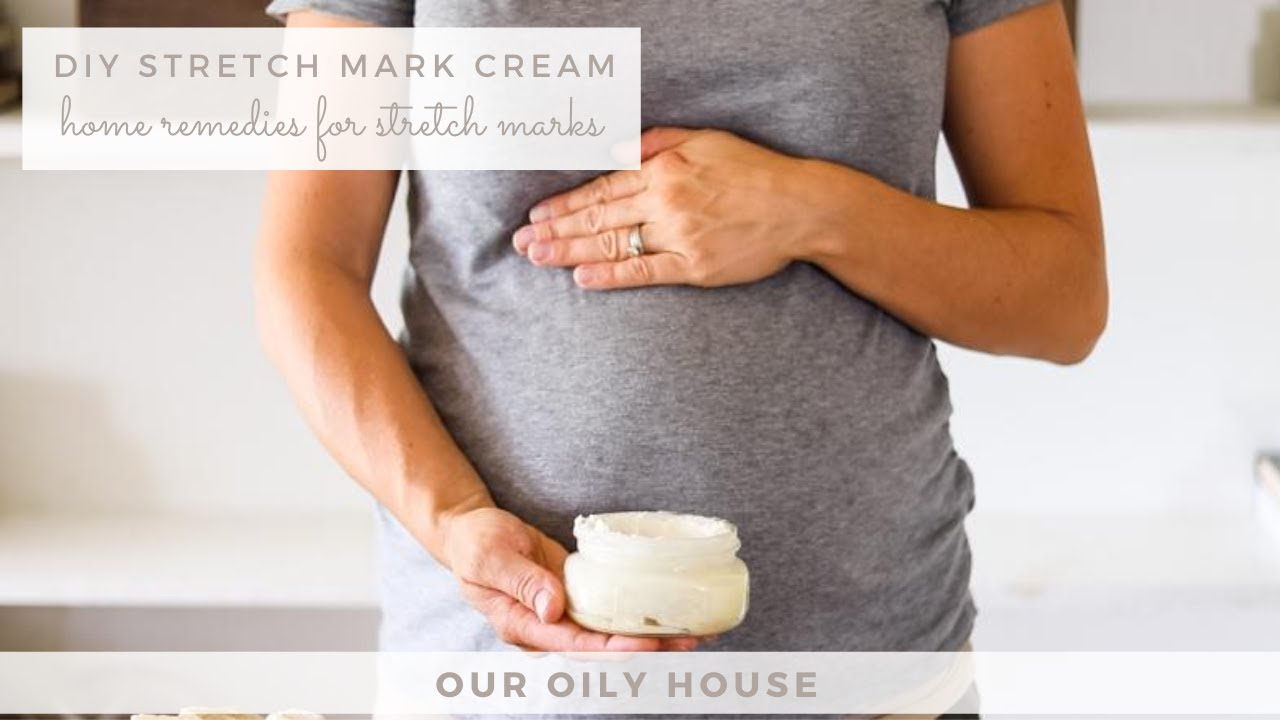 Homemade Stretch Mark Cream | Home Remedies for Stretch Marks