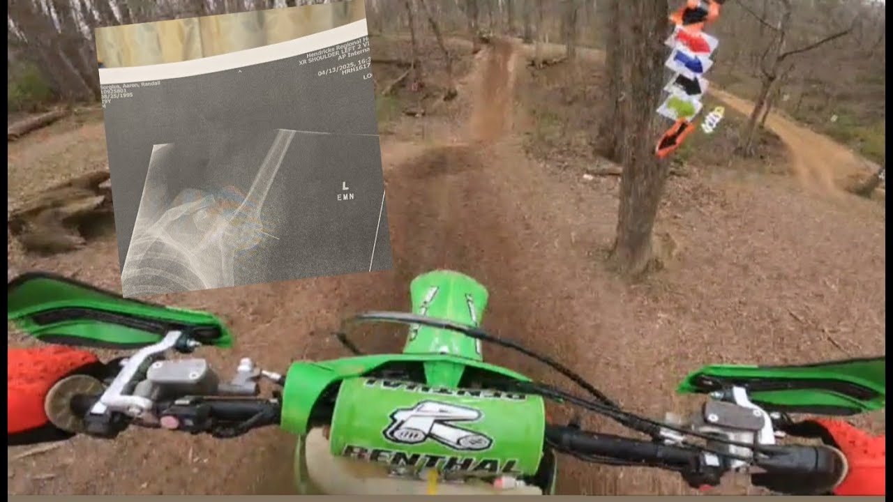Round 3 MWXC 2025 Olivers Full Throttle - Not how I wanted to end the race👎🏻