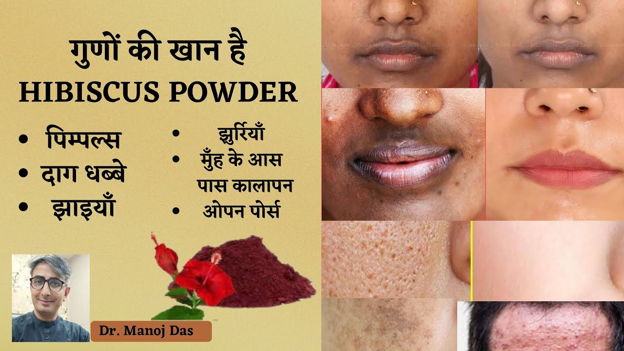 HIBISCUS POWDER BENEFITS I HIBISCUSS FLOWER FOR SKIN CARE AND HAIR CARE I DR. MANOJ DAS