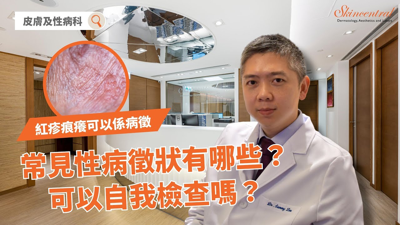 常見性病徵狀有哪些？可以自我檢查嗎？ @皮膚及性病科醫生 劉安祥醫生