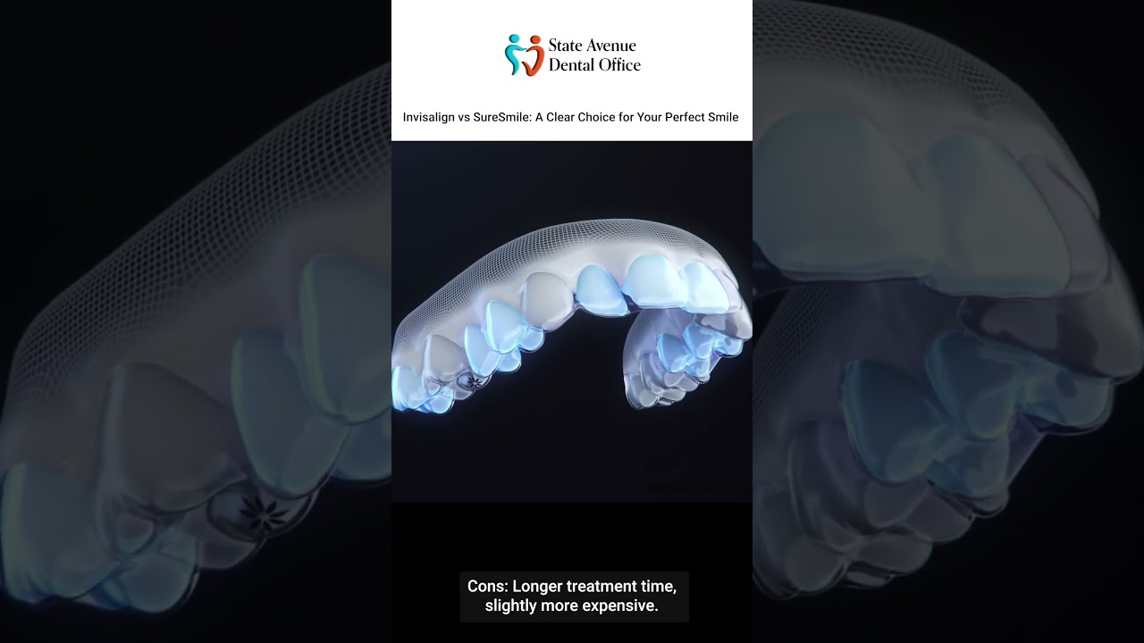 Invisalign vs SureSmile  Discover Your Path to a Perfect Smile