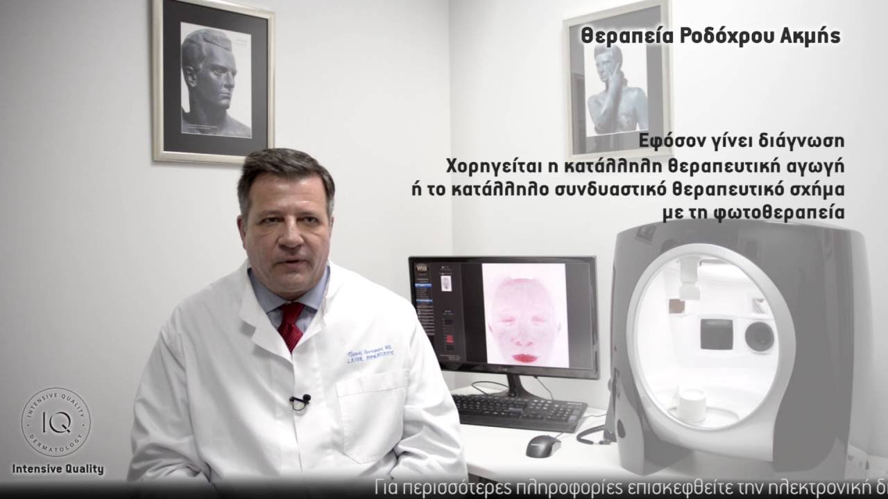 Θεραπεία ροδόχρους ακμής