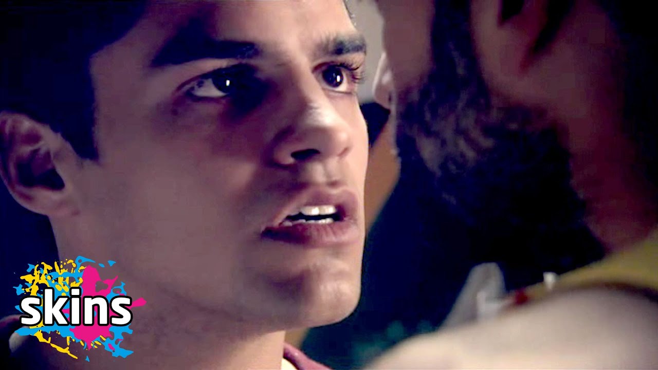 Nick Has A Breakdown - Skins
