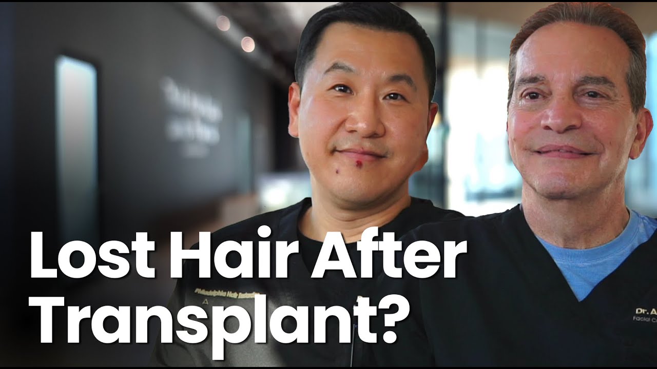 What Is Hair Transplant Shock Loss?