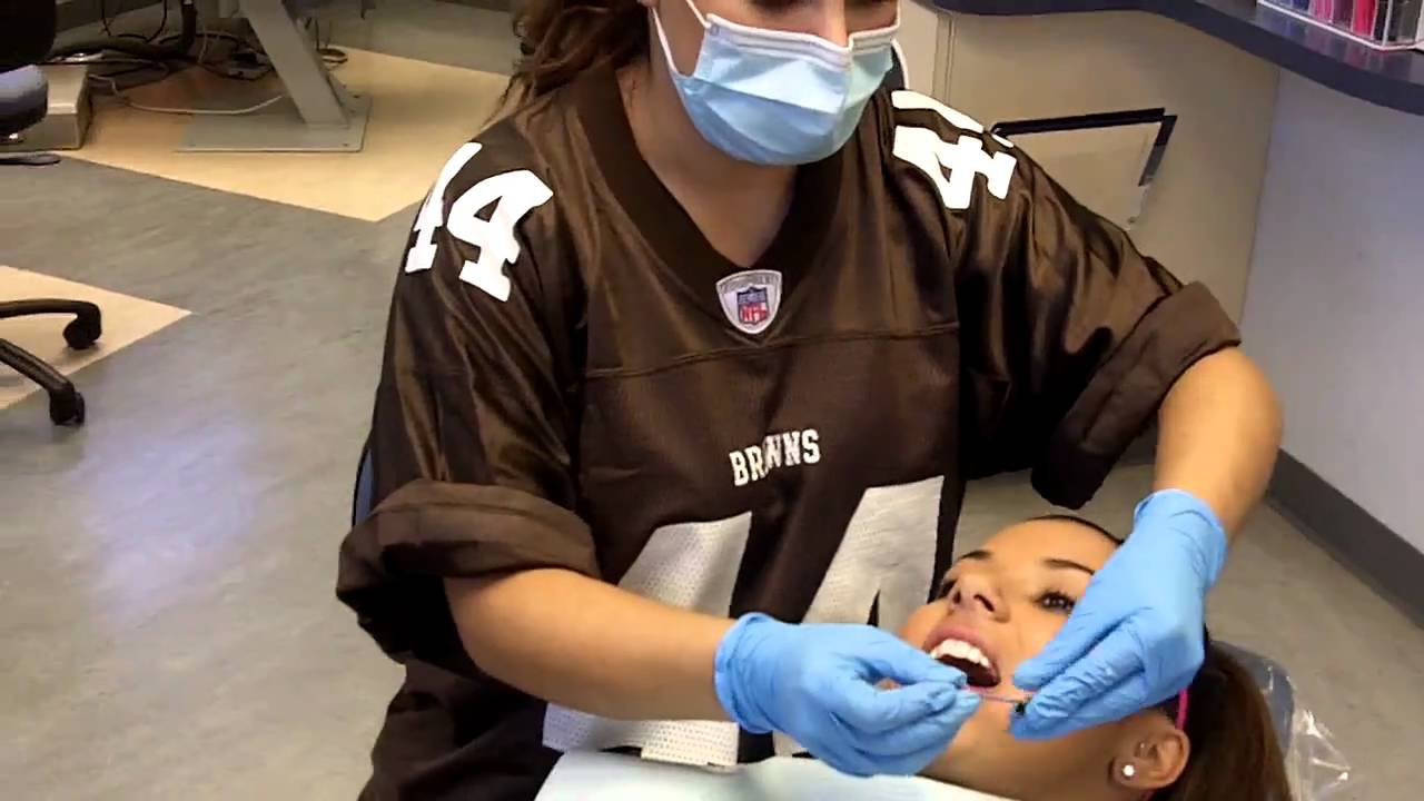 Alexis Renee in " What are Invisalign attachments for ? "