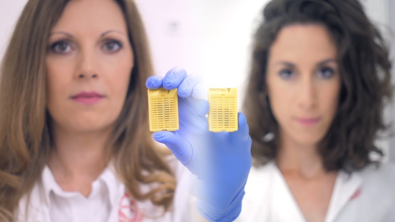 BIOPSZIÁS TEVÉKENYSÉG a Semmelweis Egyetem Patológiai és Kísérleti Rákkutató Intézetben