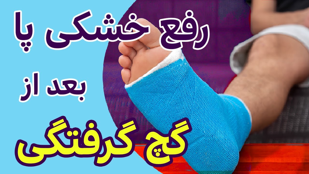 گچ پا تمرینات توانبخشی خشکی پا رفع خشکی پا|Ankle Cast super-fast rehabilitation exercises.