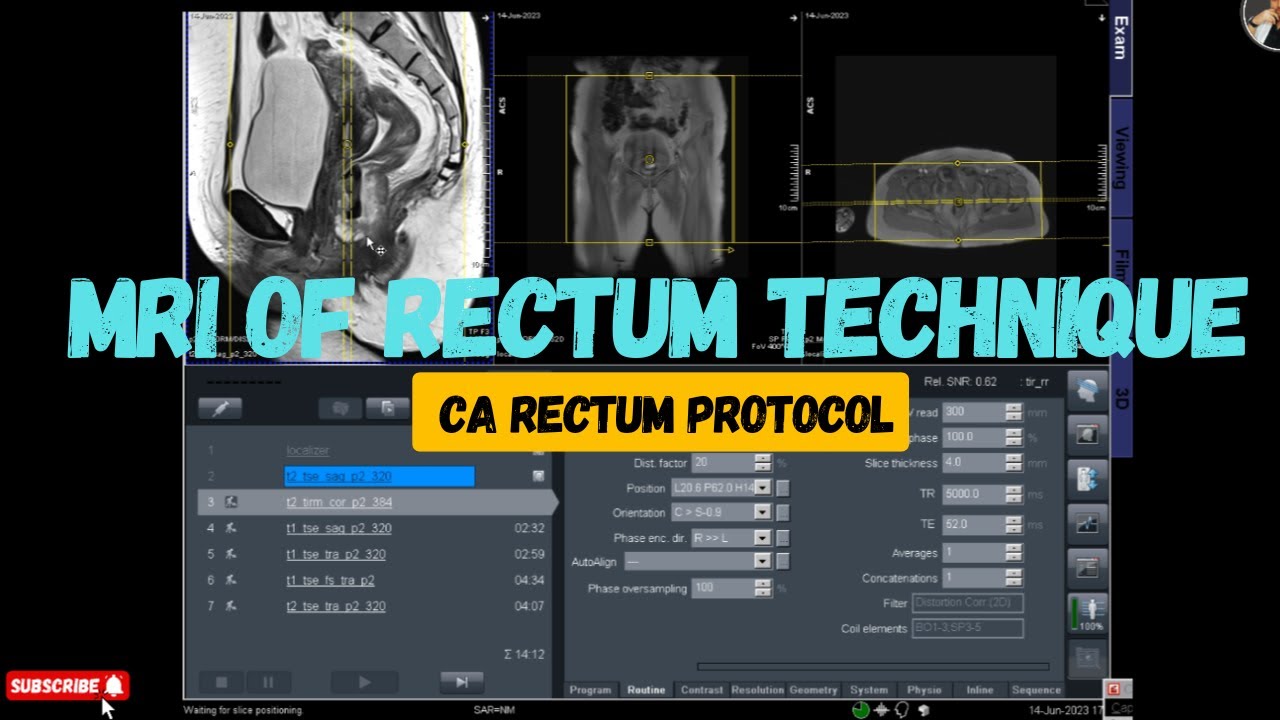 MRI of Rectum Technique | CA Rectum Protocol | Rectal Cancer Protocol | MRI Technique tutorial |